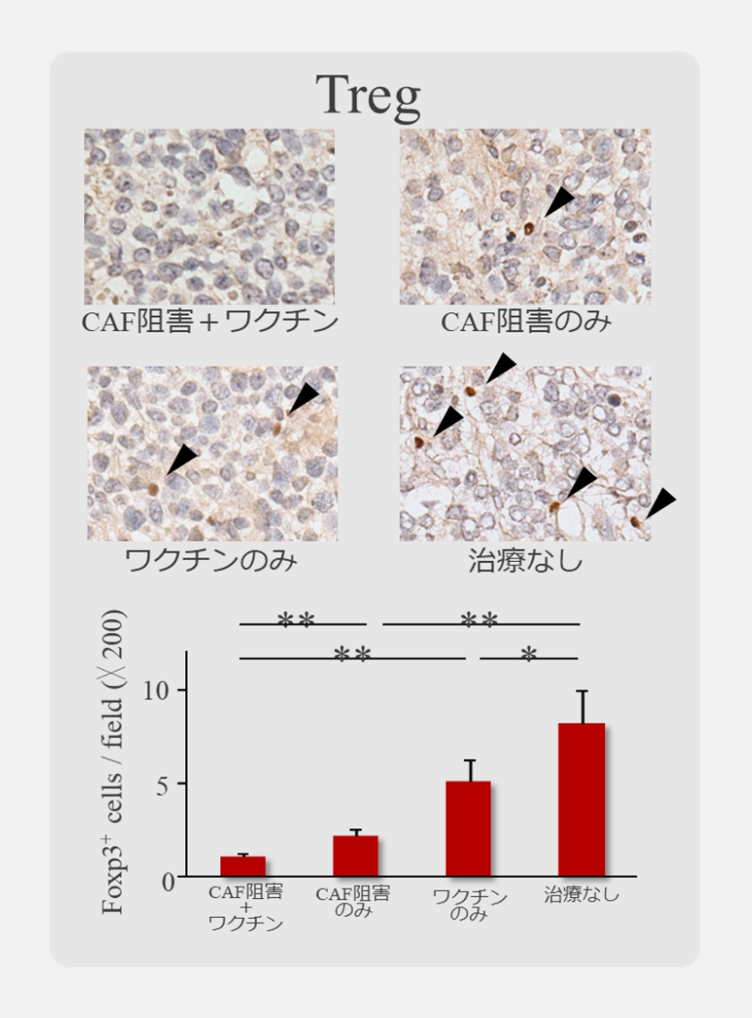 Treg 説明写真